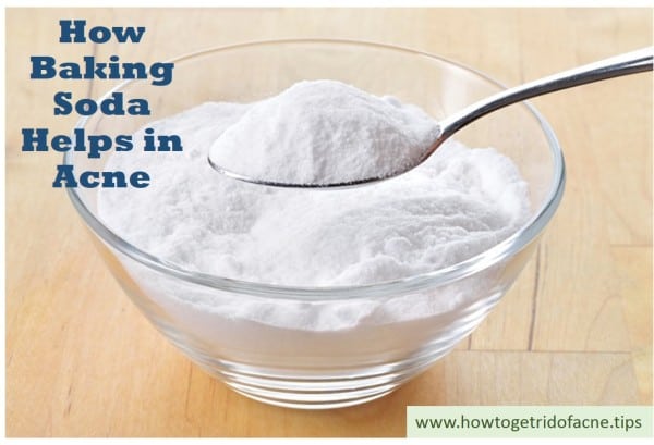 how baking soda helps in acne