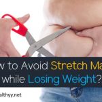 How to Avoid Stretch Marks while Losing Weight