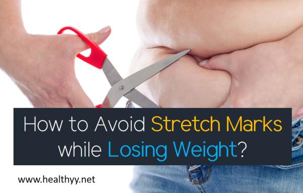 How to Avoid Stretch Marks while Losing Weight