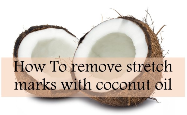 how to how to remove stretch marks with coconut oil