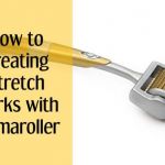 How to Treating Stretch Marks with Dermaroller 