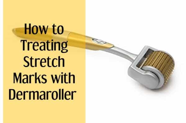 How to Treating Stretch Marks with Dermaroller 