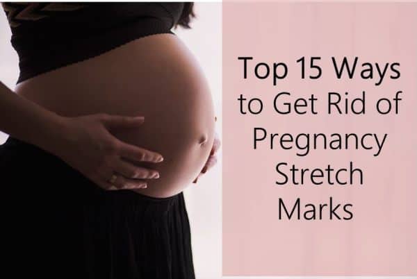 Top 15 ways to Get Rid of Pregnancy Stretch Marks