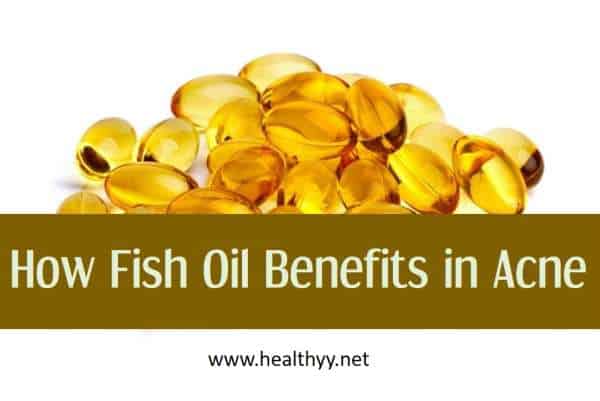 Why Fish Oil is Great for Acne