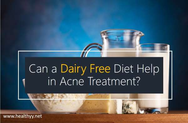 Can a Dairy Free Diet Help in Acne Treatment