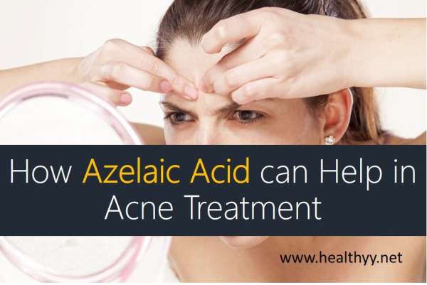 How Azelaic Acid can Help in Acne Treatment