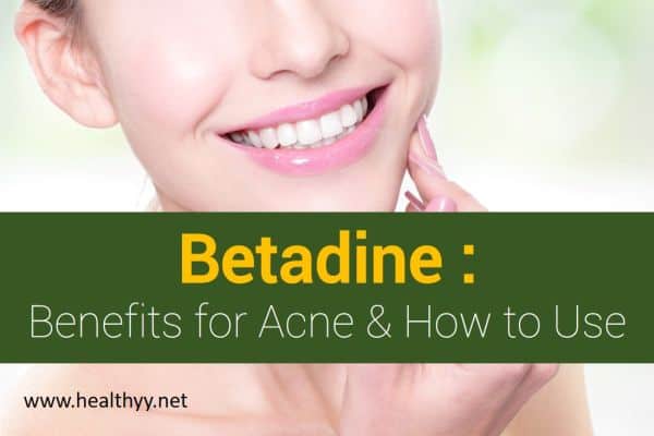 Betadine Benefits for Acne & How to Use