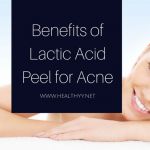 Lactic Acid Peel for Acne benefits