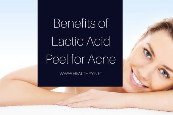 Lactic Acid Peel for Acne benefits