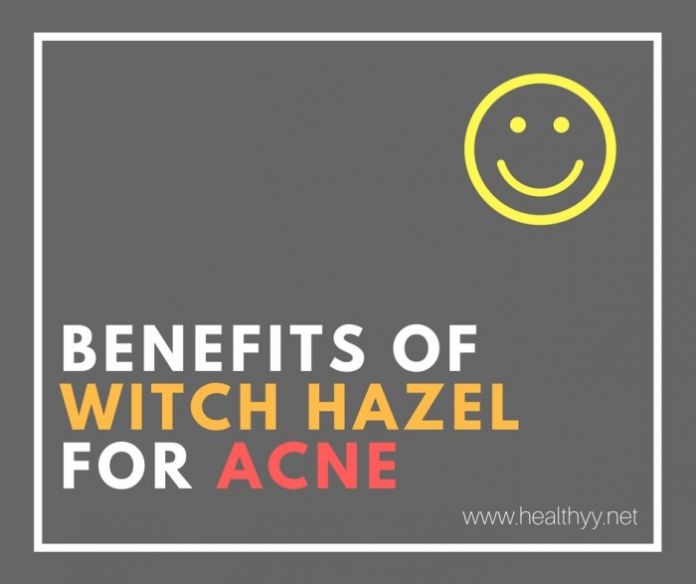 Benefits of Witch Hazel for Acne & Ho to Use It?