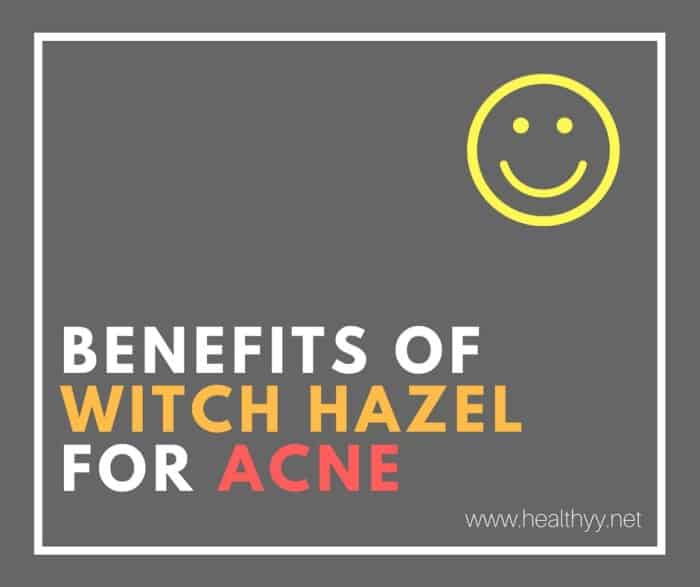 Benefits of Witch Hazel for Acne