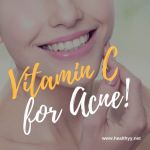 Vitamin C for Acne!