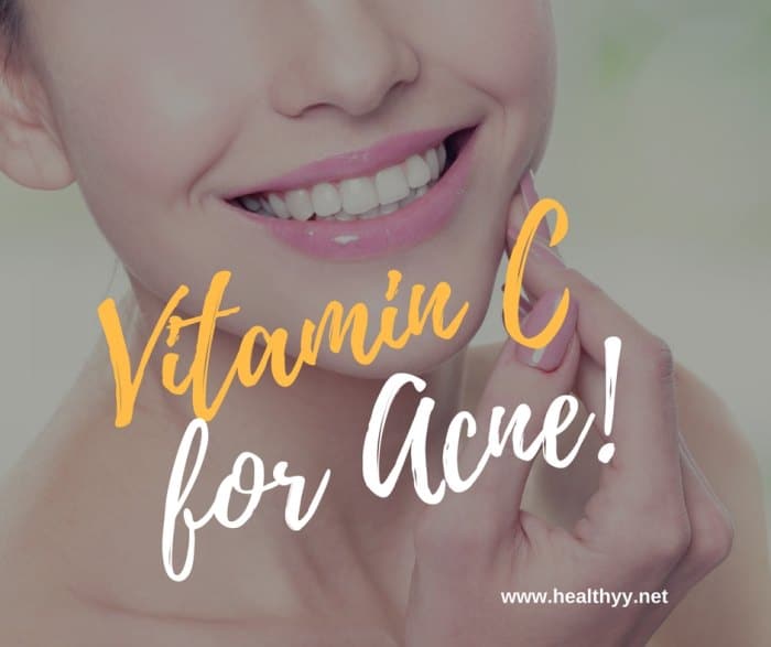 Vitamin C for Acne!