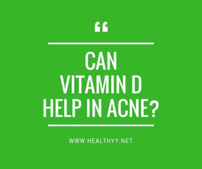 can Vitamin D help in Acne_